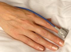 NONIN 8000SM - wiederverwendbare Fingersensoren