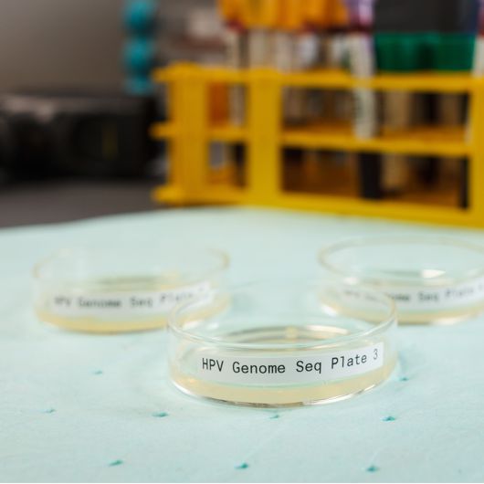 temperaturbeständige Etiketten auf Petrischalen für die Laborkennzeichnung