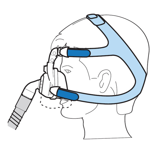 Anwendung zur SilkGel Joyce CPAP-Maske von Löwenstein
